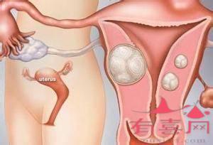 合肥49岁助孕机构-什么样的女人容易得子宫肌瘤