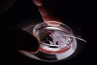 美国试管婴儿胚胎培养液起什么作用